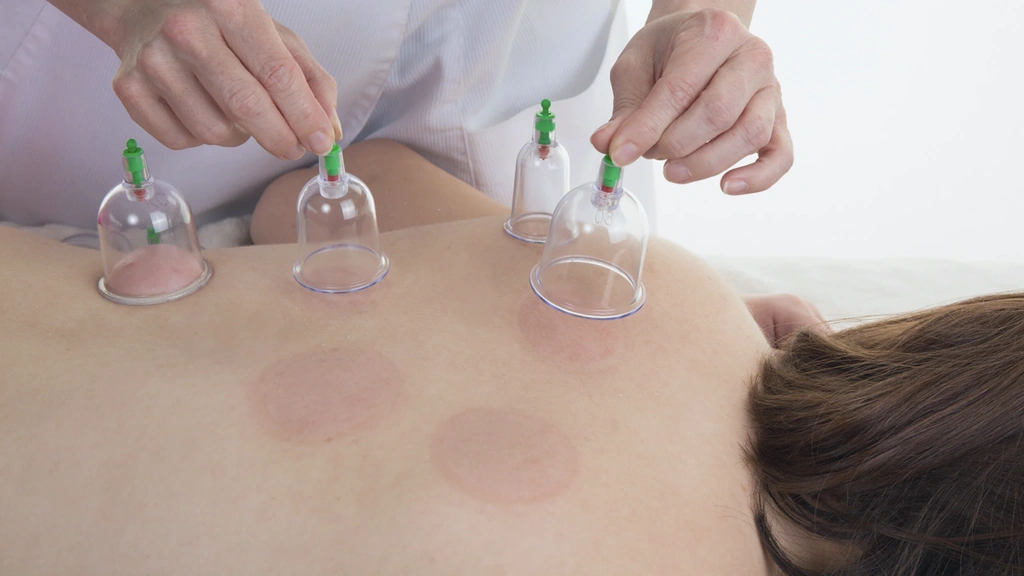 Restorative Cupping Therapy | Release Tension & Boost Recovery - Media 1